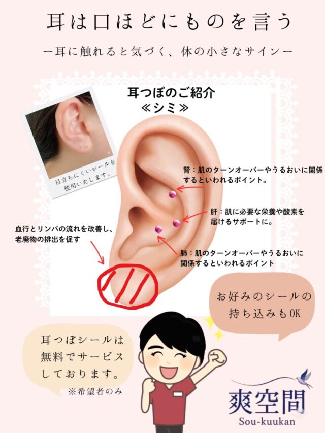 紫外線が強くなる季節、シミ対策は万全ですか？