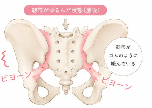 産後の骨盤矯正