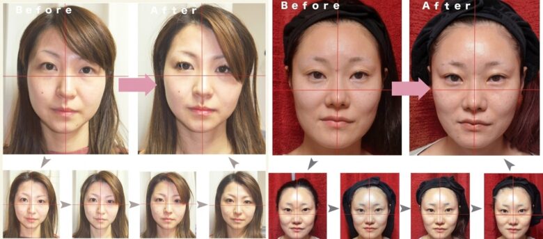 爽空間でフェイシャルを受けた方の変化画像